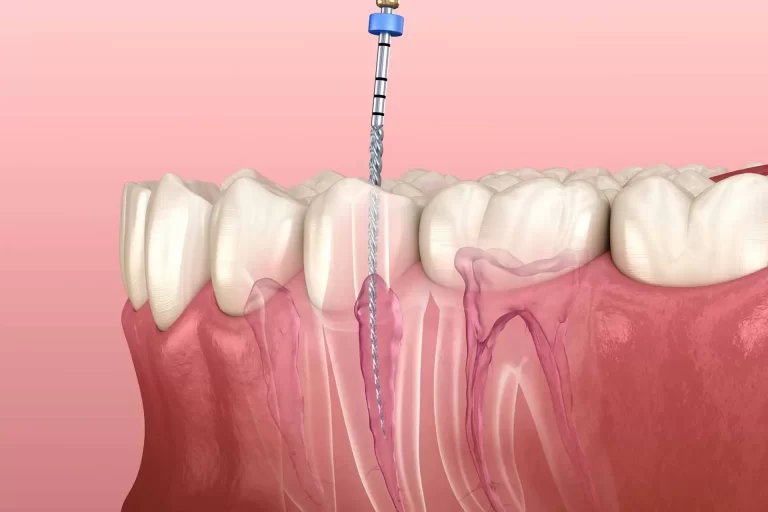 CONSERVATIVA-ED-ENDODONZIA (1)