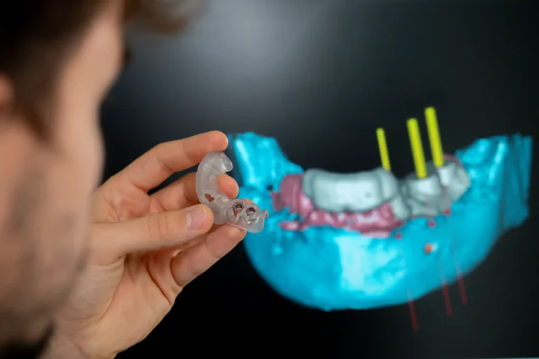 Implantologia Dentale