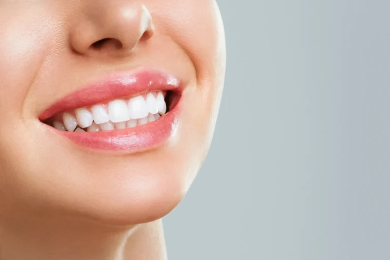 ODONTOIATRIA ESTETICA
